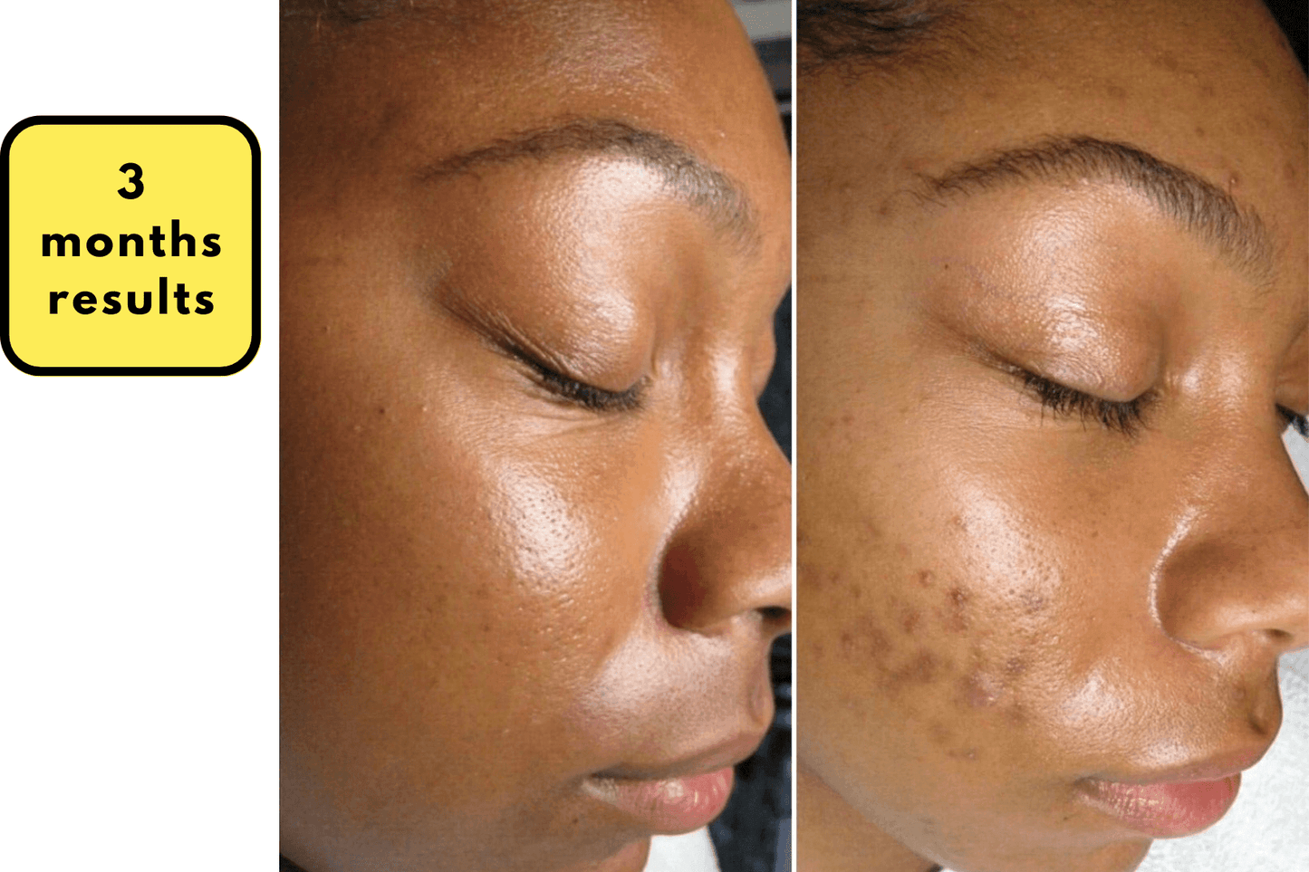 BRIGHTENING KOJIC & TURMERIC SOAP - Arabel's Naturals
