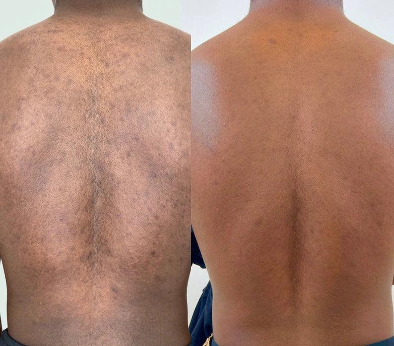 Brightening Lemon Turmeric & Kojic Acid Soap - Arabel's Naturals