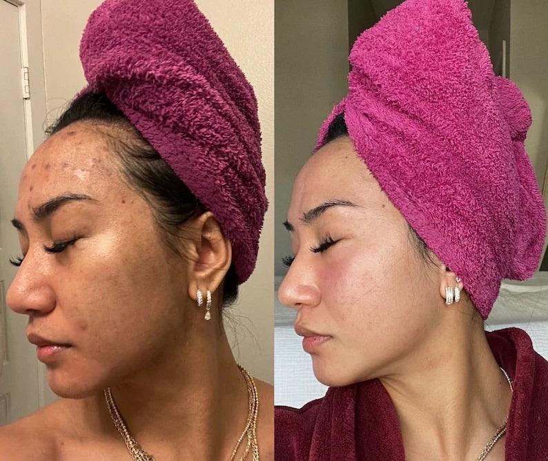 Brightening Lemon Turmeric & Kojic Acid Soap - Arabel's Naturals