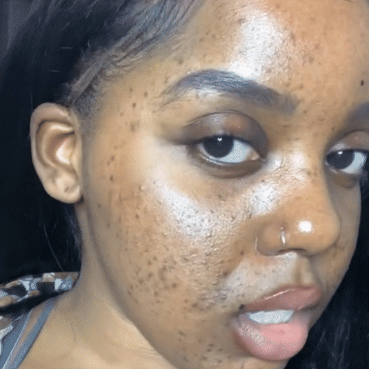 Brightening Lemon Turmeric & Kojic Acid Soap - Arabel's Naturals