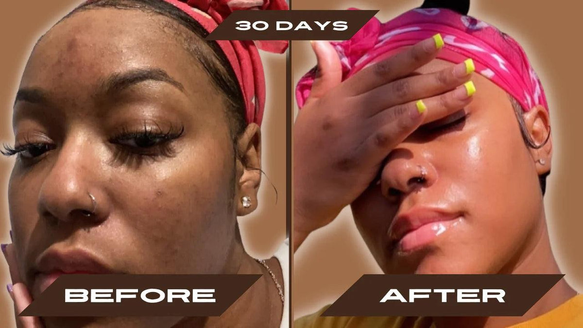 Real customer results after 30 days with Arabel's Naturals